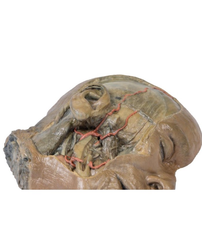 Sezione sagittale della testa con dissezione della fossa infratemporale E Sezione sagittale della testa con dissezione della fossa infratemporale E