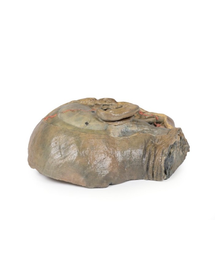 Sezione sagittale della testa con dissezione della fossa infratemporale E Sezione sagittale della testa con dissezione della fossa infratemporale E