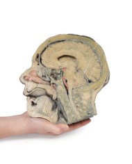 Sezione sagittale della testa con dissezione della fossa infratemporale E Sezione sagittale della testa con dissezione della fossa infratemporale E