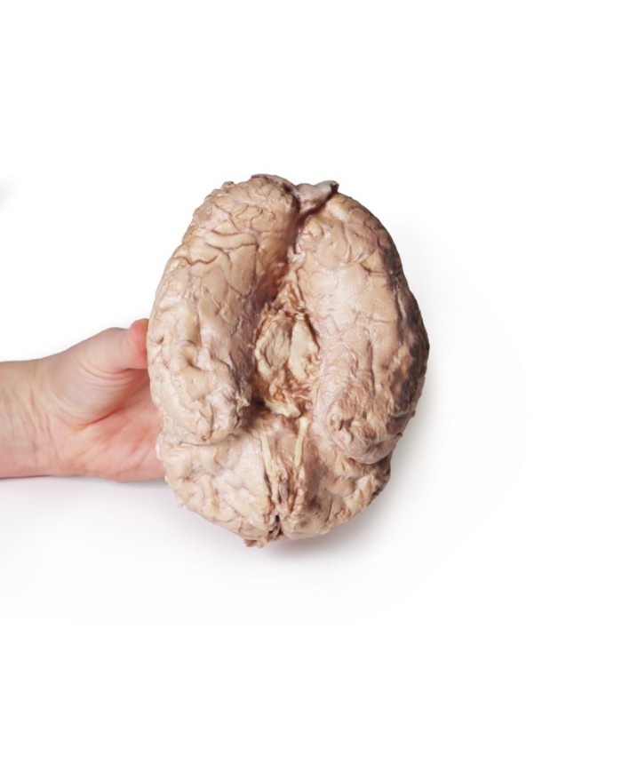 Cervello umano Erler Zimmer 3D anatomy Series MP1103 Cervello umano Erler Zimmer 3D anatomy Series MP1103