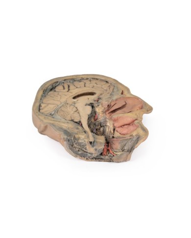 Sezione sagittale della testa con dissezione profonda Erler Zimmer 3D ana