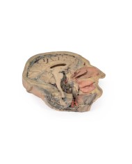 Sezione sagittale della testa con dissezione profonda Erler Zimmer 3D ana Sezione sagittale della testa con dissezione profonda Erler Zimmer 3D ana