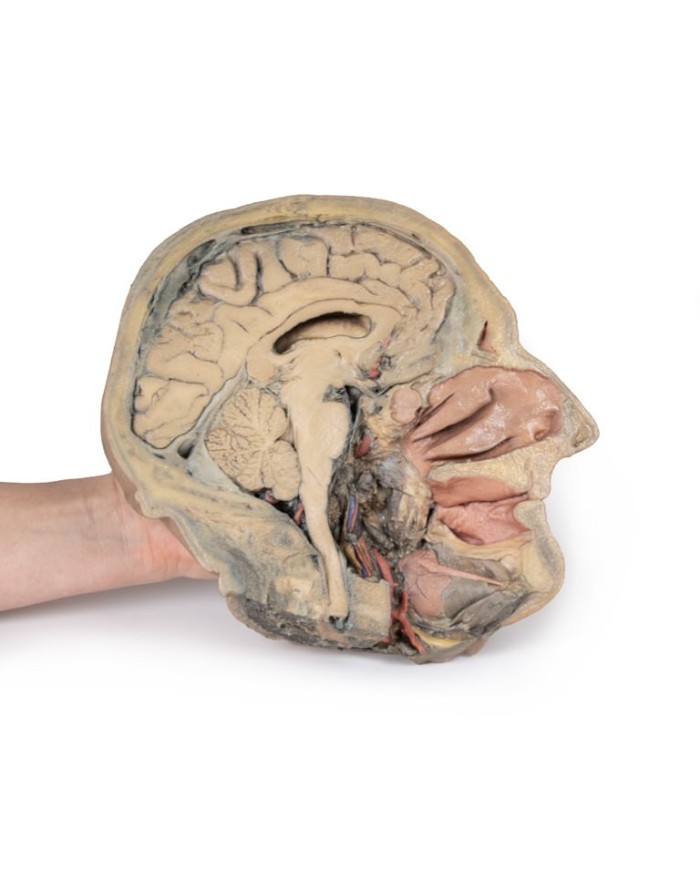 Sezione sagittale della testa con dissezione profonda Erler Zimmer 3D ana Sezione sagittale della testa con dissezione profonda Erler Zimmer 3D ana