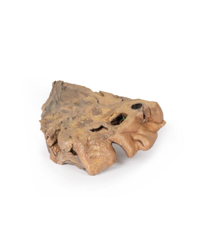 Vie del seno paranasale Erler Zimmer 3D anatomy Series MP1106