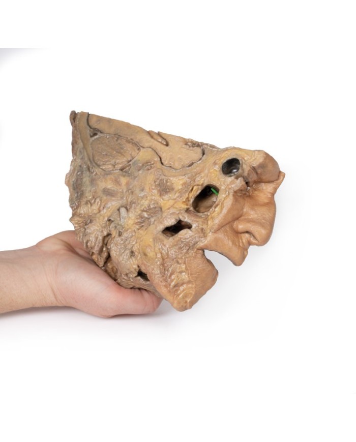 Vie del seno paranasale Erler Zimmer 3D anatomy Series MP1106