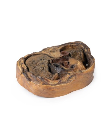 Sezione del torace sulla vertebra T6 Erler Zimmer 3D anatomy Series MP112