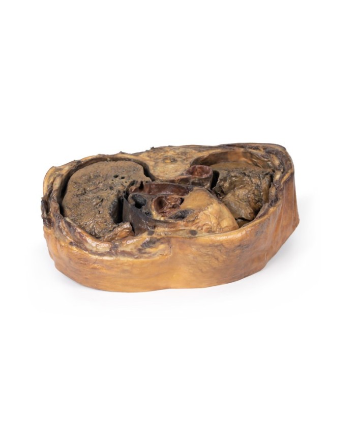 Sezione del torace sulla vertebra T6 Erler Zimmer 3D anatomy Series MP112