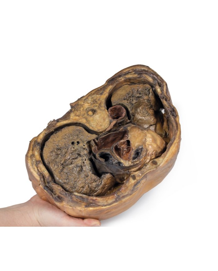 Sezione del torace sulla vertebra T6 Erler Zimmer 3D anatomy Series MP112