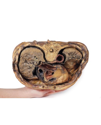 Sezione del torace sulla vertebra T6 Erler Zimmer 3D anatomy Series MP112