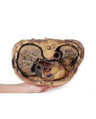 Sezione del torace sulla vertebra T6 Erler Zimmer 3D anatomy Series MP112