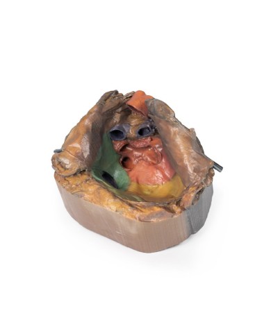 Spazio pericardico Erler Zimmer 3D anatomy Series MP1121