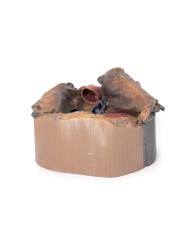 Spazio pericardico Erler Zimmer 3D anatomy Series MP1121