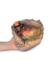 Spazio pericardico Erler Zimmer 3D anatomy Series MP1121