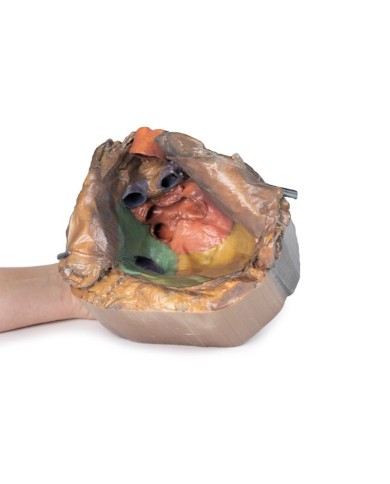 Spazio pericardico Erler Zimmer 3D anatomy Series MP1121