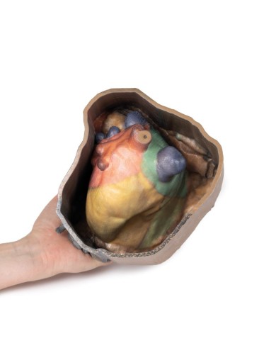 Spazio pericardico Erler Zimmer 3D anatomy Series MP1121