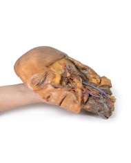 Sezione sagittale di testa e collo con fossa intratemporale e guaina caroti