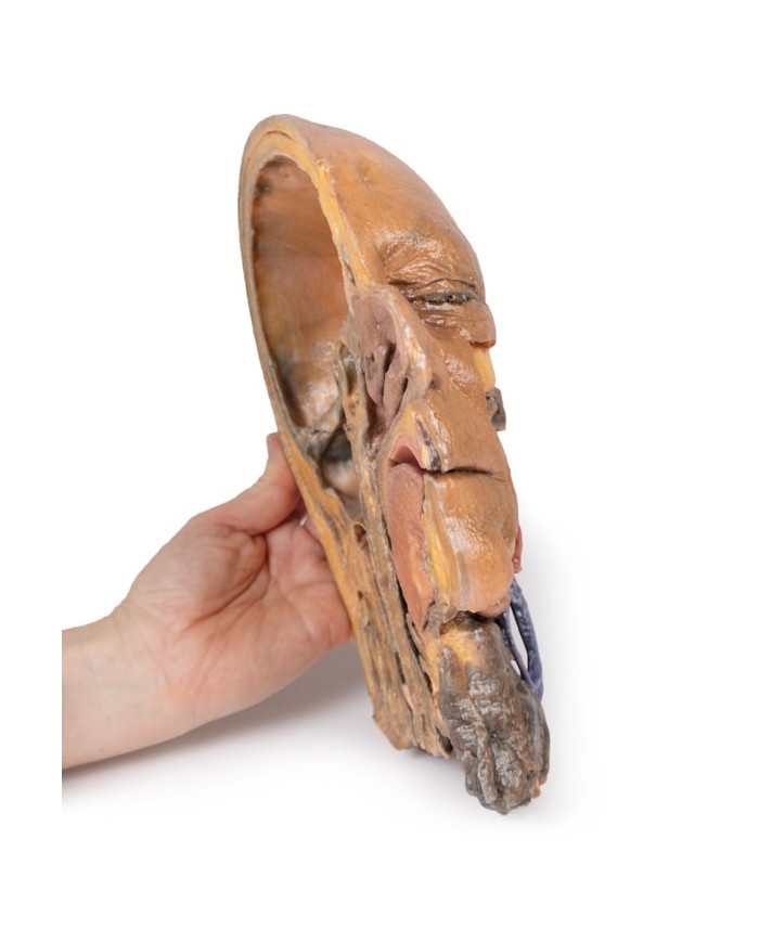 Sezione sagittale di testa e collo con fossa intratemporale e guaina caroti