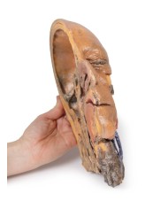 Sezione sagittale di testa e collo con fossa intratemporale e guaina caroti