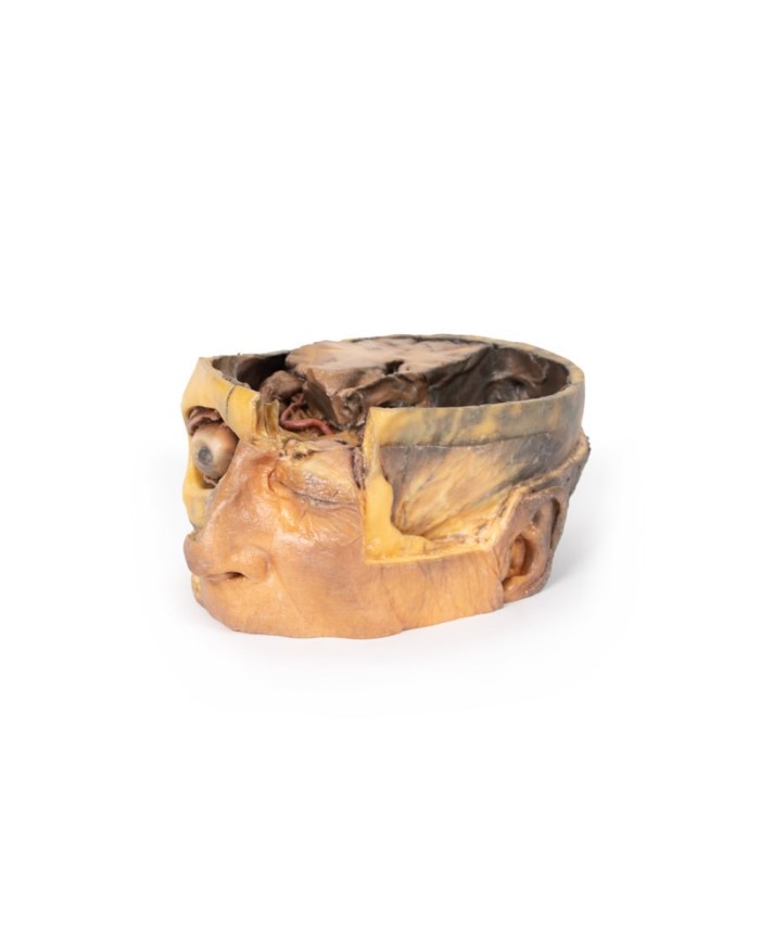 Sezione trasversale della testa Erler Zimmer 3D anatomy Series MP1110