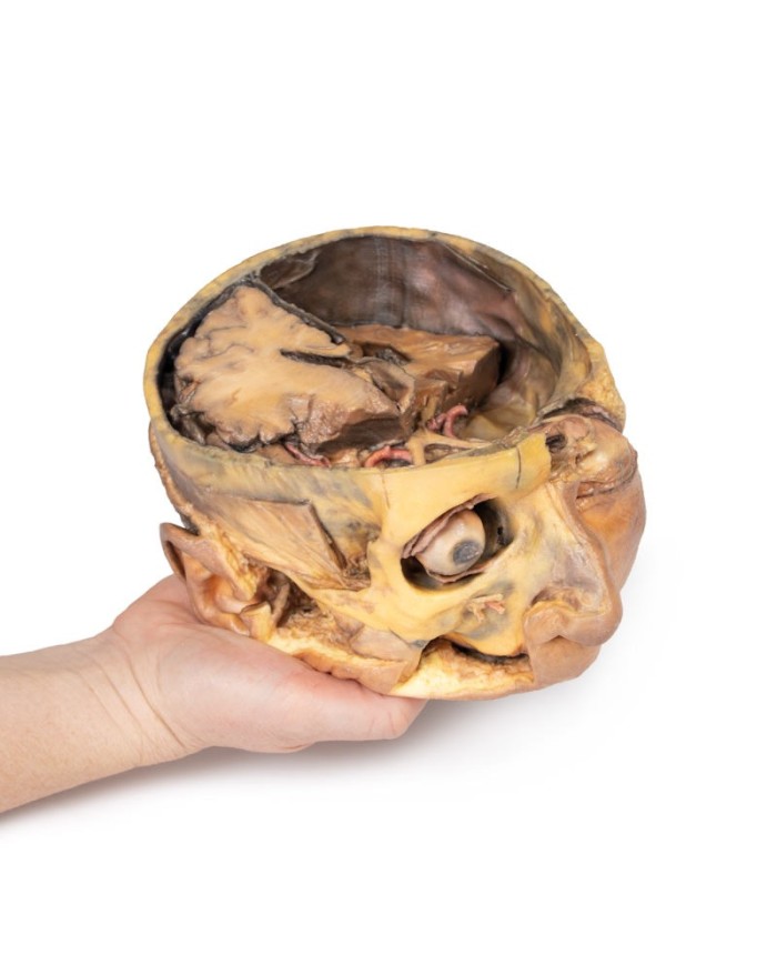 Sezione trasversale della testa Erler Zimmer 3D anatomy Series MP1110