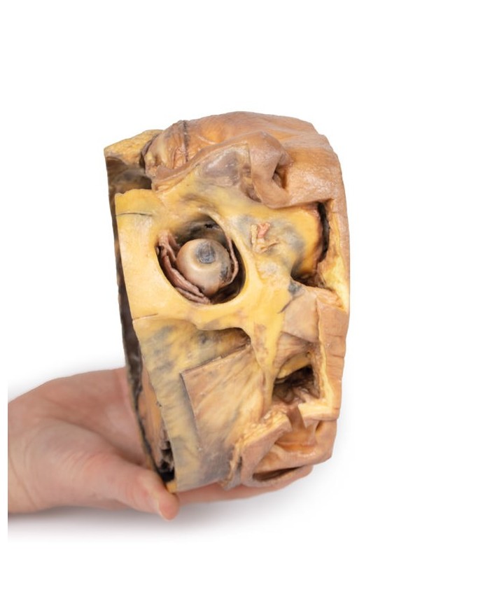 Sezione trasversale della testa Erler Zimmer 3D anatomy Series MP1110