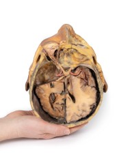 Sezione trasversale della testa Erler Zimmer 3D anatomy Series MP1110