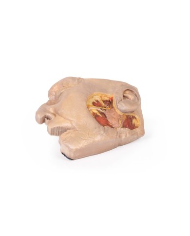 Dissezione della ghiandola parotide e del nervo facciale Erler Zimmer 3D 