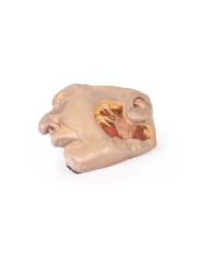 Dissezione della ghiandola parotide e del nervo facciale Erler Zimmer 3D  Dissezione della ghiandola parotide e del nervo facciale Erler Zimmer 3D