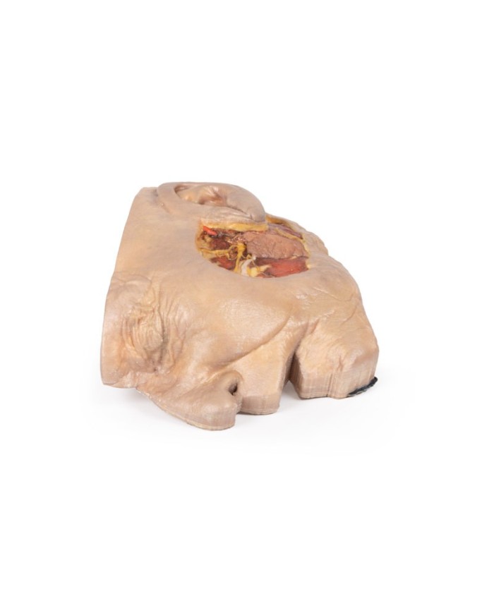 Dissezione della ghiandola parotide e del nervo facciale Erler Zimmer 3D  Dissezione della ghiandola parotide e del nervo facciale Erler Zimmer 3D