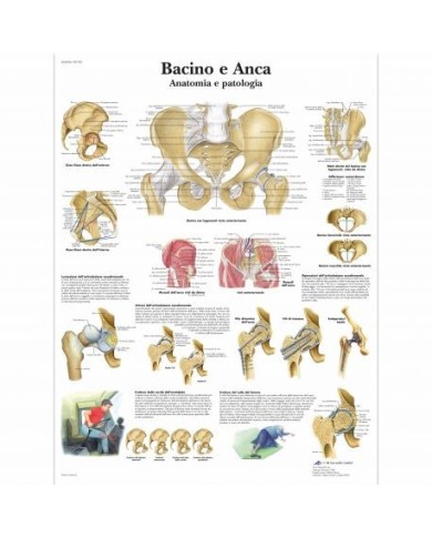 3B Scientific, tavola anatomica, Bacino e Anca - Anatomia e patologia (cod, VR4172L) 3B Scientific, tavola anatomica, Bacino e Anca - Anatomia e patologia (cod, VR4172L)