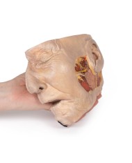 Dissezione della ghiandola parotide e del nervo facciale Erler Zimmer 3D  Dissezione della ghiandola parotide e del nervo facciale Erler Zimmer 3D