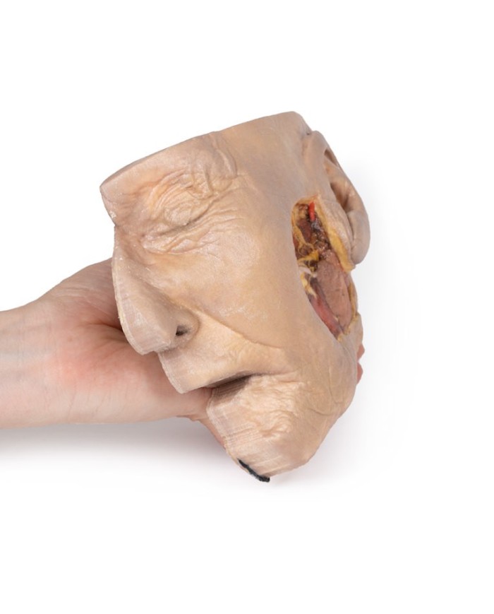 Dissezione della ghiandola parotide e del nervo facciale Erler Zimmer 3D  Dissezione della ghiandola parotide e del nervo facciale Erler Zimmer 3D