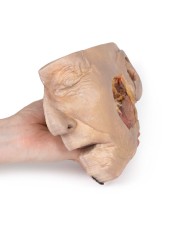 Dissezione della ghiandola parotide e del nervo facciale Erler Zimmer 3D  Dissezione della ghiandola parotide e del nervo facciale Erler Zimmer 3D