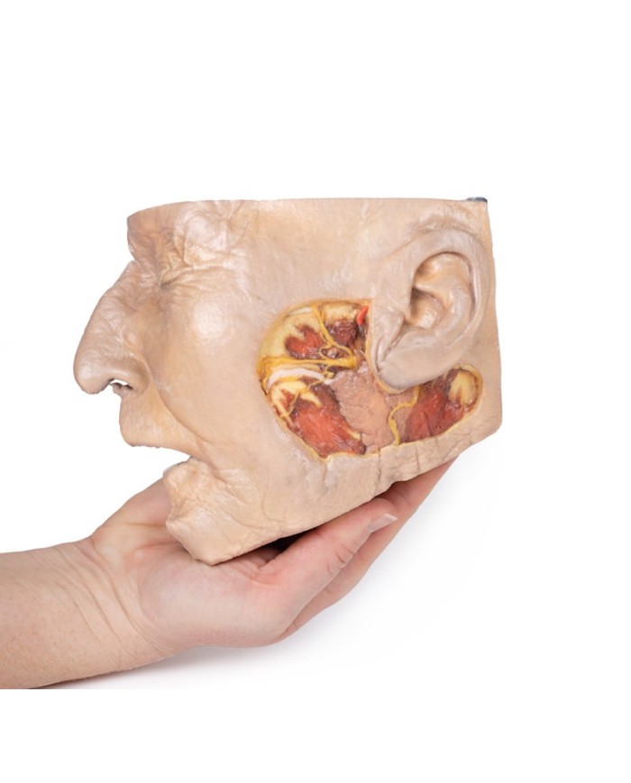 Dissezione della ghiandola parotide e del nervo facciale Erler Zimmer 3D  Dissezione della ghiandola parotide e del nervo facciale Erler Zimmer 3D