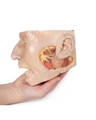 Dissezione della ghiandola parotide e del nervo facciale Erler Zimmer 3D  Dissezione della ghiandola parotide e del nervo facciale Erler Zimmer 3D