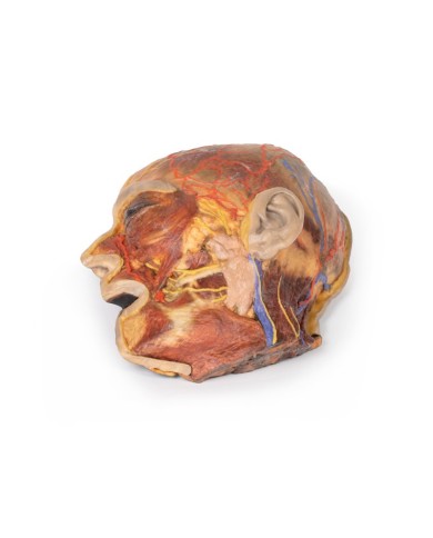 Nervi facciali superficiali e ghiandola parotide Erler Zimmer 3D anatomy 