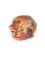 Nervi facciali superficiali e ghiandola parotide Erler Zimmer 3D anatomy  Nervi facciali superficiali e ghiandola parotide Erler Zimmer 3D anatomy