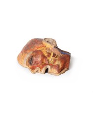 Nervi facciali superficiali e ghiandola parotide Erler Zimmer 3D anatomy  Nervi facciali superficiali e ghiandola parotide Erler Zimmer 3D anatomy