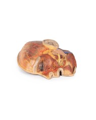 Nervi facciali superficiali e ghiandola parotide Erler Zimmer 3D anatomy  Nervi facciali superficiali e ghiandola parotide Erler Zimmer 3D anatomy