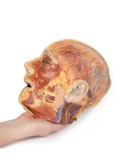 Nervi facciali superficiali e ghiandola parotide Erler Zimmer 3D anatomy  Nervi facciali superficiali e ghiandola parotide Erler Zimmer 3D anatomy