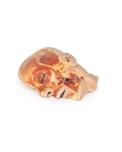 Dissezione superficiale del volto Erler Zimmer 3D anatomy Series MP1108