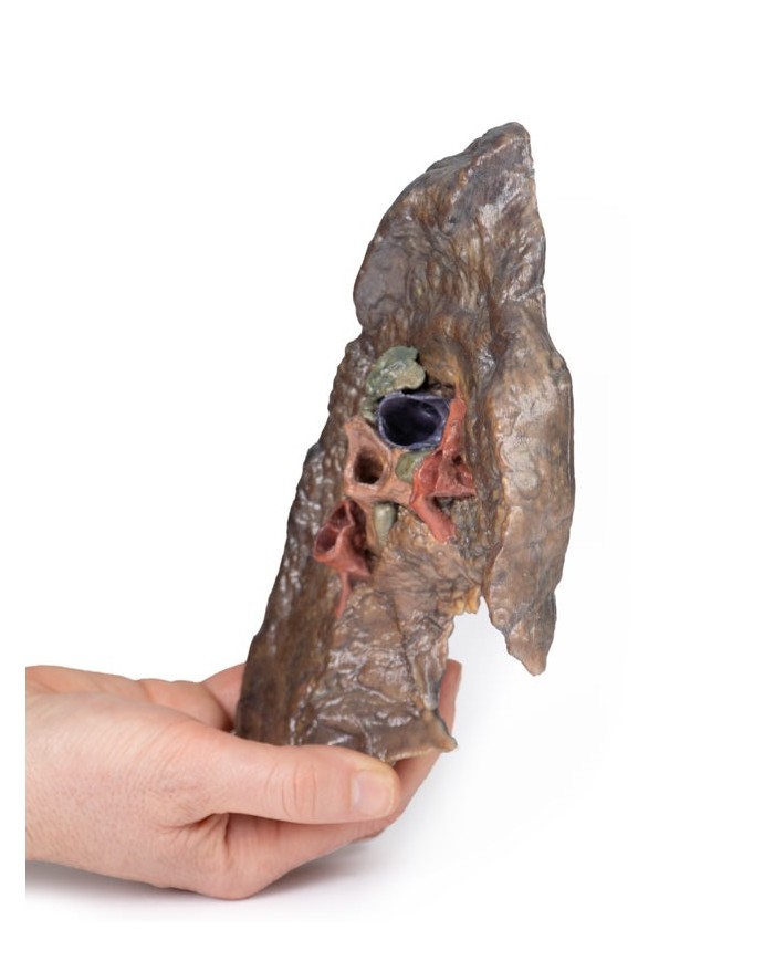 Ilo del polmone sinistro Erler Zimmer 3D anatomy Series MP1124