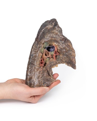 Ilo del polmone sinistro Erler Zimmer 3D anatomy Series MP1124