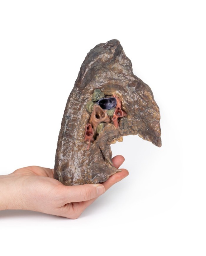 Ilo del polmone sinistro Erler Zimmer 3D anatomy Series MP1124