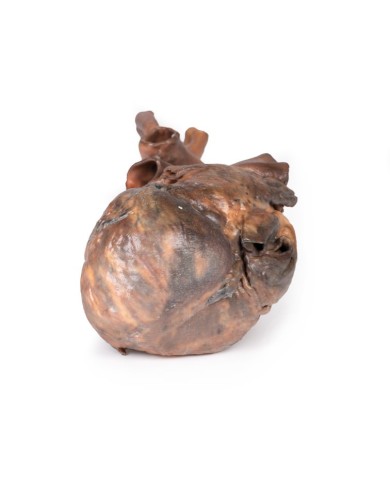 Dissezione del cuore umano Erler Zimmer 3D anatomy Series MP1123