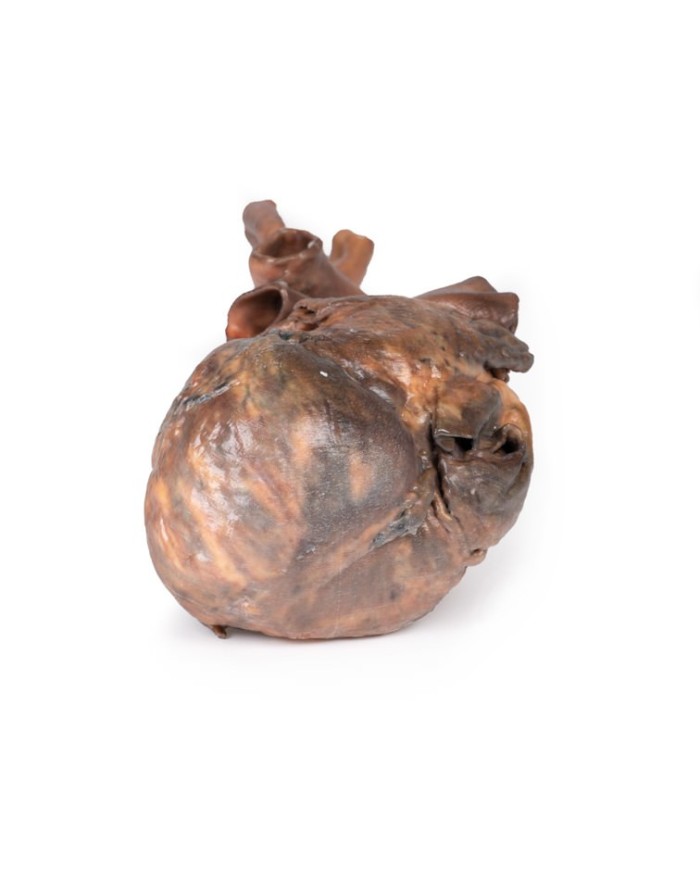 Dissezione del cuore umano Erler Zimmer 3D anatomy Series MP1123