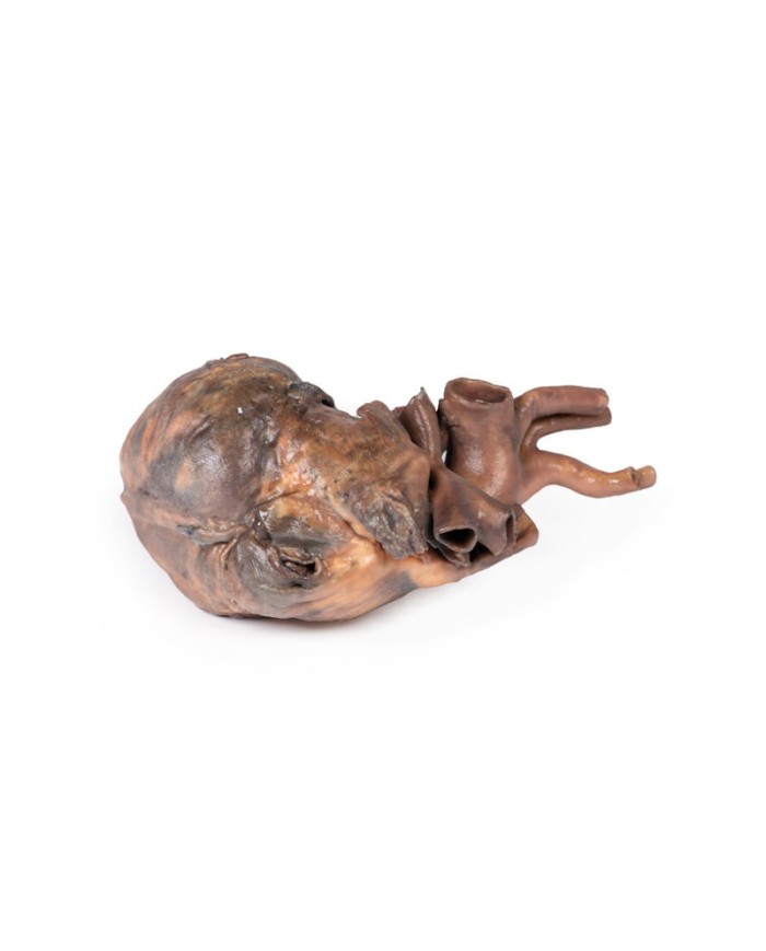 Dissezione del cuore umano Erler Zimmer 3D anatomy Series MP1123