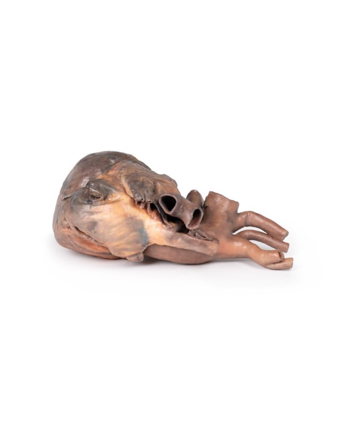 Dissezione del cuore umano Erler Zimmer 3D anatomy Series MP1123