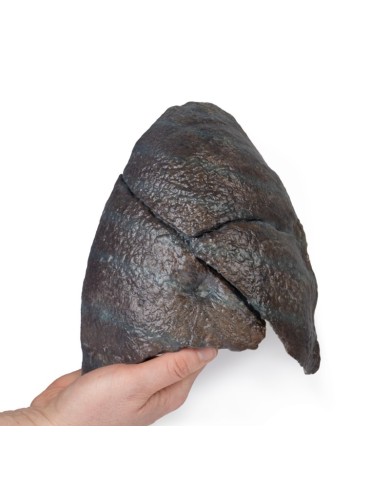 Polmone destro ilo rimosso Erler Zimmer 3D anatomy Series MP1126