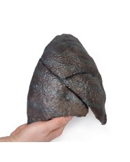 Polmone destro ilo rimosso Erler Zimmer 3D anatomy Series MP1126